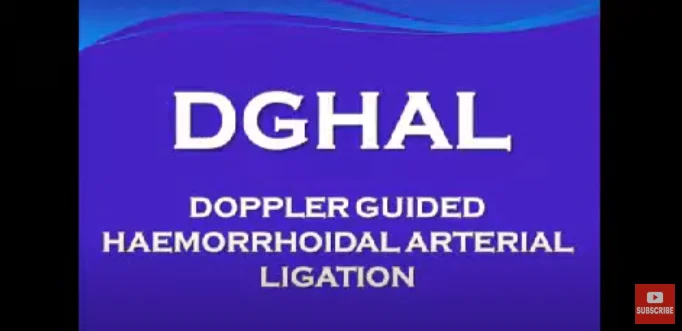 DGHAL-RAR (Doppler Guided Haemorrhoidal Artery Ligation)