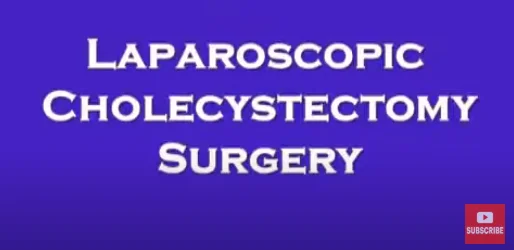 Laparoscopic Cholecystectomy – Dr.Nitish Jhawar