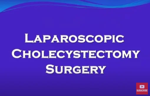 Laparoscopic cholecystectomy –Gall stone disease (cholilithiasis)