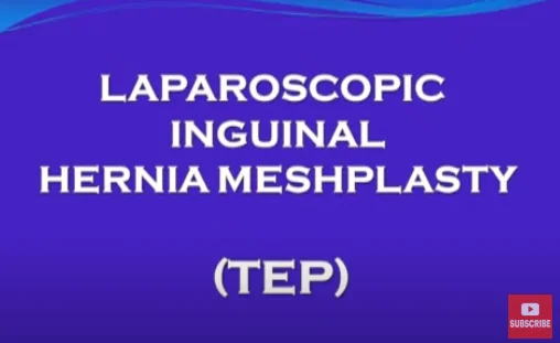 Laparoscopic Inguinal Hernia Meshplasty (TEP) surgery