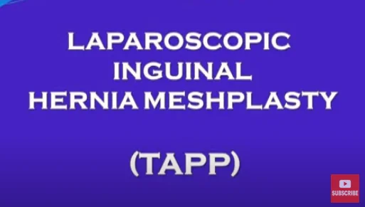 Laparoscopic Inguinal Hernia Repair (TAPP) by Dr Nitish Jhawar