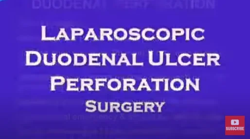 Laparoscopic Duodenum Perforation Repair surgery