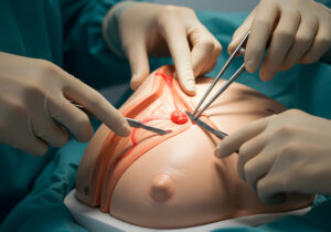 best hernia specialists in Navi Mumbai