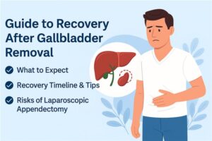 Recovery After Laparoscopic Gallbladder Removal